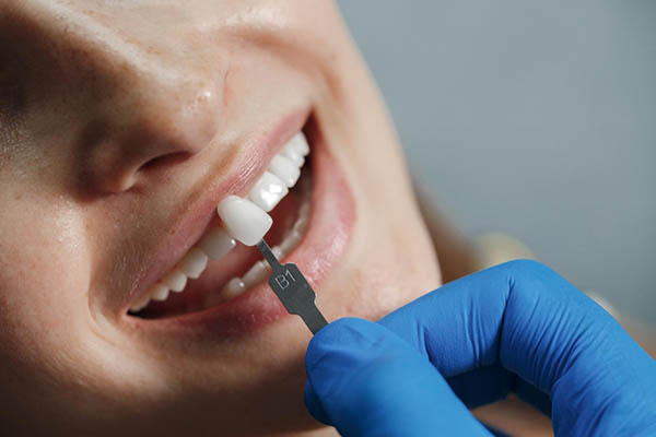 dentist showing teeth whitening options