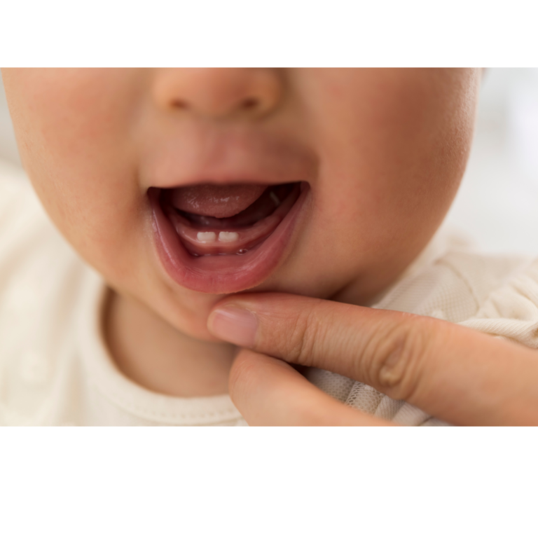 Baby with slight smile as adult fingers pull lip down to show two small baby teeth