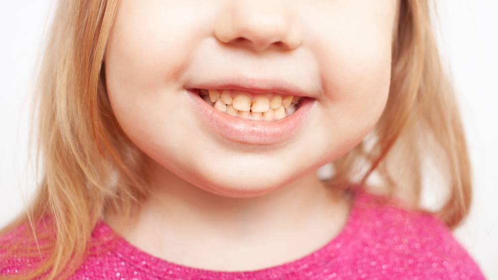 Smiling child is a pediatric patient of Ames Dentistry