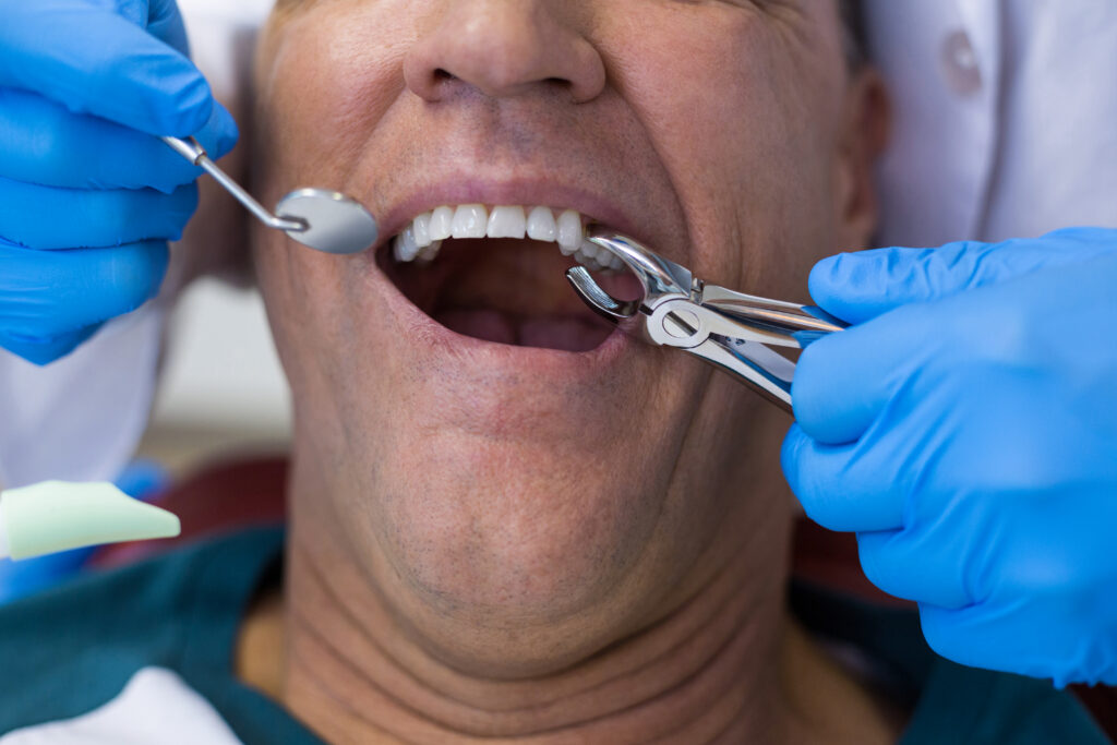 root canal vs extraction